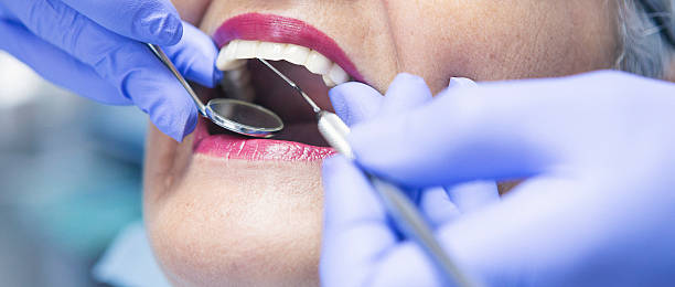 Best Emergency Dental Filling Replacement  in Cuba, MO